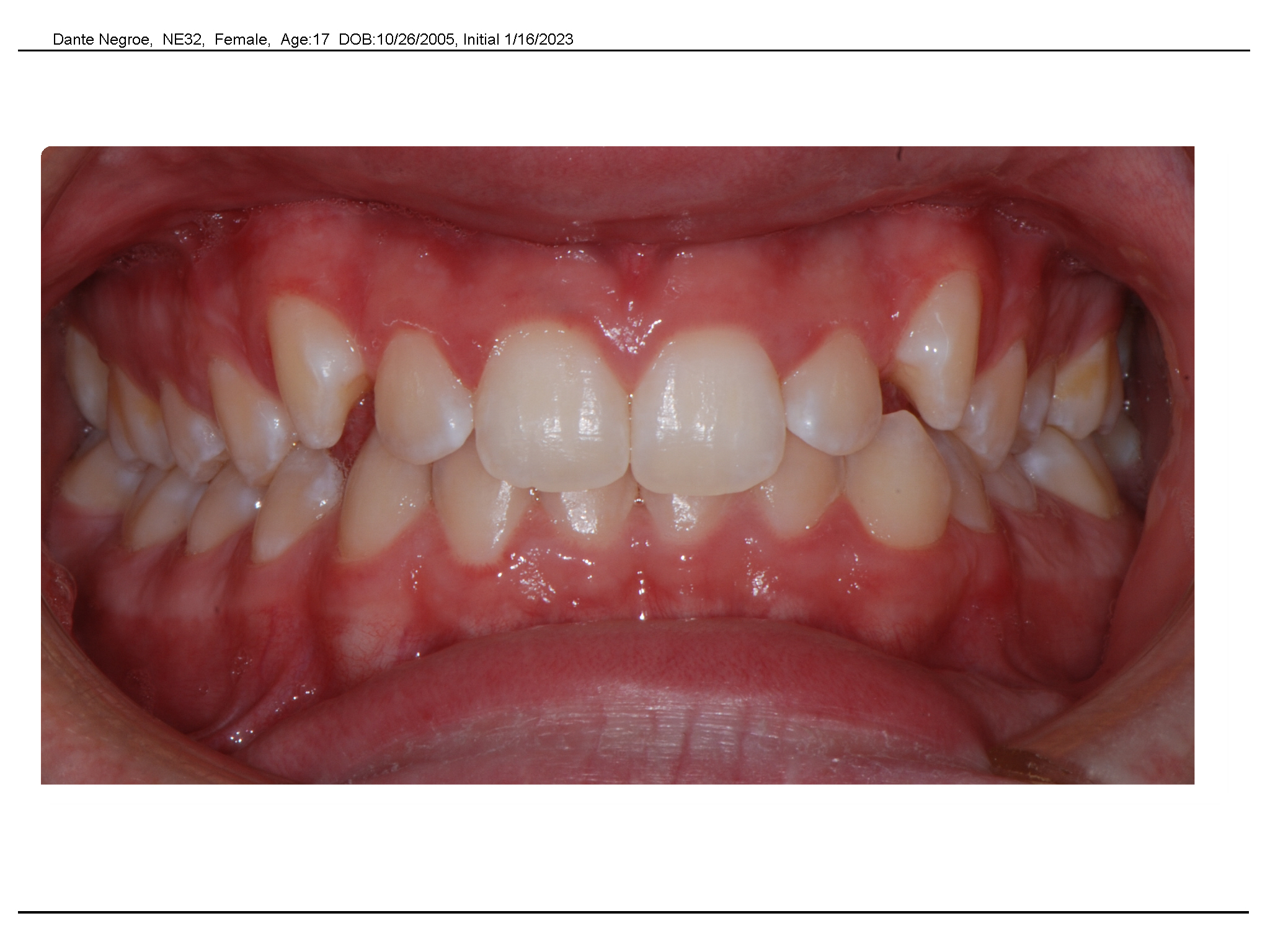 Before
